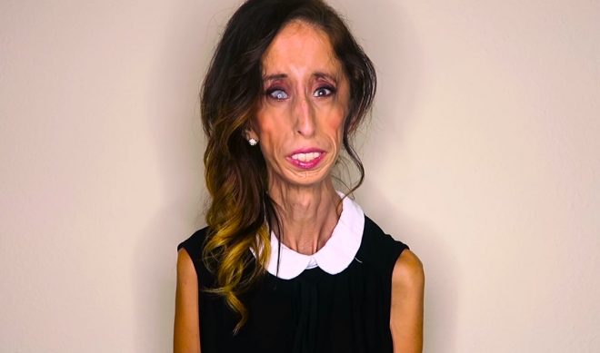 Celebrities Stand With Lizzie Velasquez To Fight Back Against Bullies