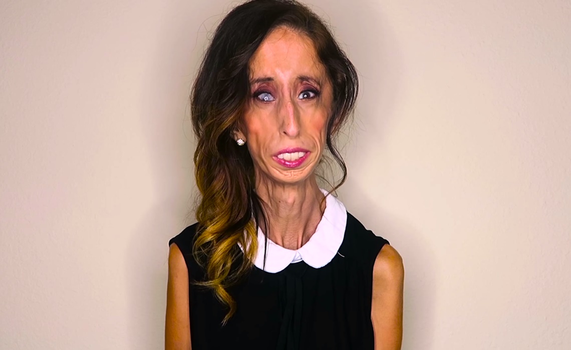 Lizzie Velasquez, the star of the recent documentary 'A Brave Hear...