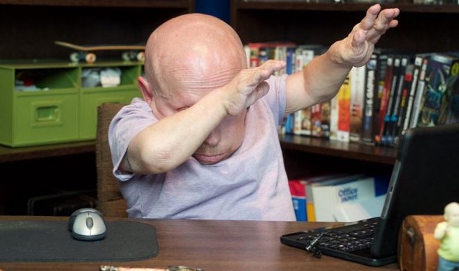 Studio71 Signs Actor Verne Troyer, Adding To Its Roster Of Mainstream Celebs