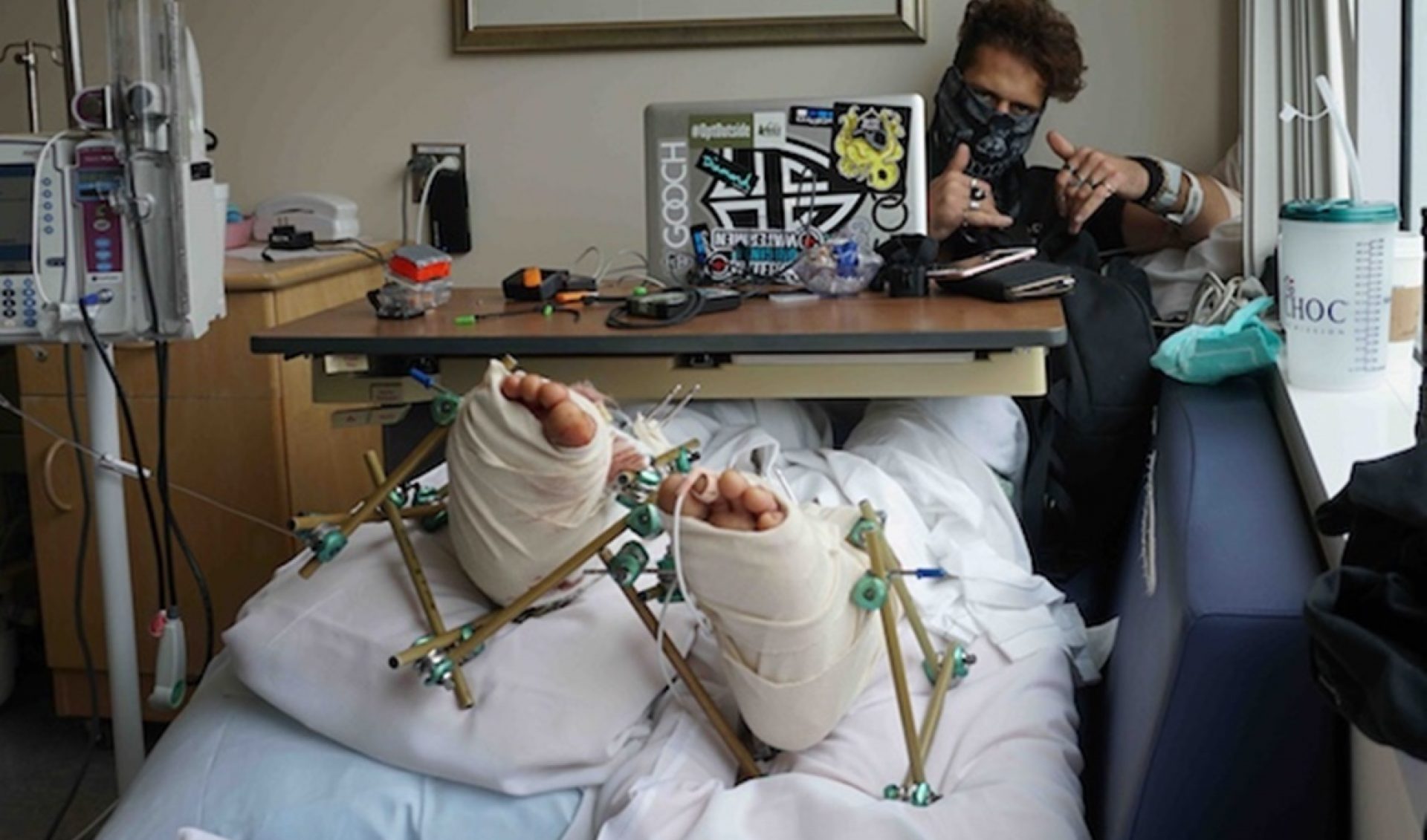 YouTuber Known For Extreme “Pool Drops” Seeks $10,000 After Breaking Legs