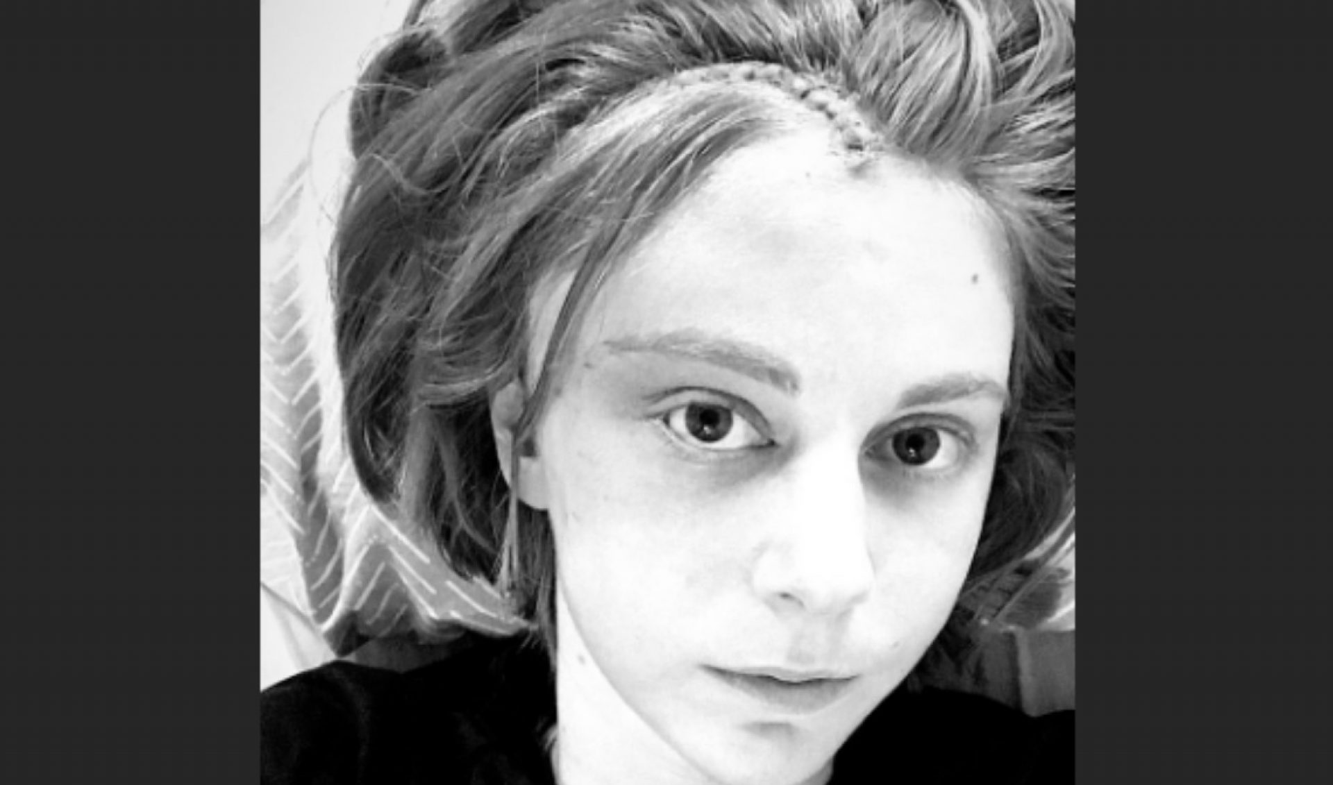 YouTube Star Simone Giertz Provides Post-Brain Surgery Update